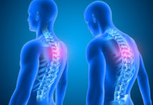 Alla Blue Clinic di Bagno a Ripoli la “Settimana della Postura”, fra prevenzione e correzione