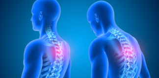 Alla Blue Clinic di Bagno a Ripoli la “Settimana della Postura”, fra prevenzione e correzione